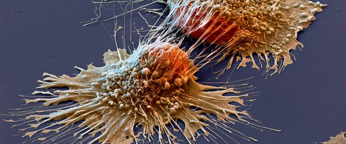 Alimlər xərçəngdən qorunmağın yolunu tapıb